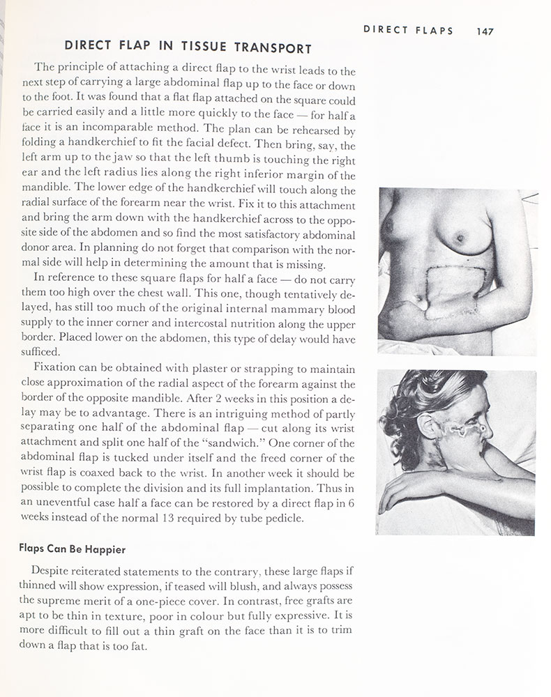 The Principles and Art of Plastic Surgery.